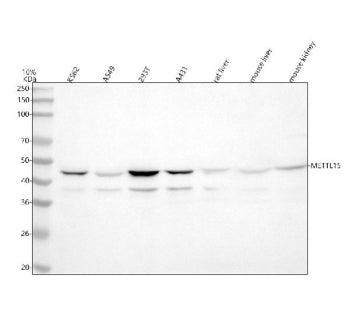 Western blot analysis of METTL15 using anti-METTL15 antibody. Lane 1: human K562 whole cell lysates, Lane 2: human whole cell lysates, Lane 3: human 293T whole cell lysates, Lane 4: human whole cell lysates, Lane 5: rat liver tissue lysates, Lane 6: mouse liver tissue lysates, Lane 7: mouse kidney tissue lysates. After electrophoresis, proteins were transferred to a nitrocellulose membrane at 150 mA for 50-90 min. Blocked the membrane with 5% non-fat milk/TBS for 1.5 hour at RT.