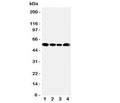 Western blot testing of MCT5 antibody and lysate from 1: rat testis; 2: human Jurkat; 3: (h) HeLa; 4: (h) MCF-7 cells. Predicted molecular weight: ~54 kDa.