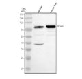 Western blot analysis of TGM7 using anti-TGM7 antibody. Electrophoresis was performed on a 10% SDS-PAGE gel at 80V (Stacking gel) / 120V (Resolving gel) for 2 hours. Lane 1: rat liver tissue lysates Lane 2: mouse liver tissue lysates. After electrophoresis, proteins were transferred to a nitrocellulose membrane at 150 mA for 50-90 min. Blocked the membrane with 5% non-fat milk/TBS for 1.5 hour at RT.