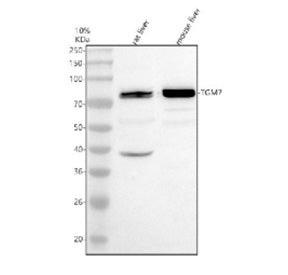 Western blot analysis of TGM7 using anti-TGM7 antibody. Electrophoresis was performed on a 10% SDS-PAGE gel at 80V (Stacking gel) / 120V (Resolving gel) for 2 hours. Lane 1: rat liver tissue lysates Lane 2: mouse liver tissue lysates. After electrophoresis, proteins were transferred to a nitrocellulose membrane at 150 mA for 50-90 min. Blocked the membrane with 5% non-fat milk/TBS for 1.5 hour at RT.