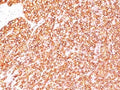 IHC testing of FFPE human tonsil with anti-CD45 antibody (clone SPM570).