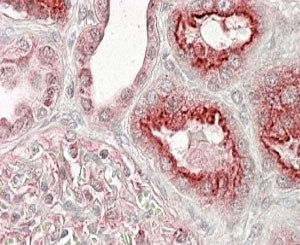 IHC testing of FFPE human kidney with VSP11 antibody at 4ug/ml. HIER: steamed with pH6 citrate buffer, AP-staining.