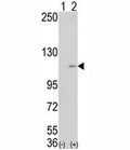 Western blot analysis of LSD1 antibody and 293 cell lysate (2 ug/lane) either nontransfected (Lane 1) or transiently transfected with the AOF2 gene (2). Expected molecular weight ~110kDa.