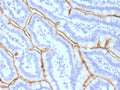 IHC staining of FFPE human small intestine tissue with MUC13 antibody (clone MUC13/13111). HIER: boil tissue sections in pH 9 10mM Tris with 1mM EDTA for 20 min and allow to cool before testing.