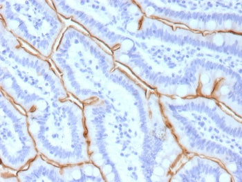 IHC staining of FFPE human small intestine tissue with MUC13 antibody (clone MUC13/13111). HIER: boil tissue sections in pH 9 10mM Tris with 1mM EDTA for 20 min and allow to cool before testing.
