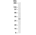 Western blot testing of rat adipose lysate with UCP2 antibody at 1ug/ml. Predicted molecular weight ~34 kDa.