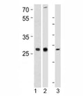 Western blot analysis of 1) human CEM, 2) rat PC-12, and 3) mouse spleen tissue lysate using LIF antibody at 1:1000. Observed molecular weight ~23/32~62kDa (unmodified/glycosylated).