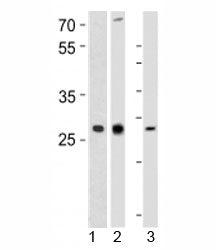 Western blot analysis of 1) human CEM, 2) rat PC-12, and 3) mouse spleen tissue lysate using LIF antibody at 1:1000. Observed molecular weight ~23/32~62kDa (unmodified/glycosylated).