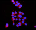 Immunofluorescent staining of FFPE human MCF7 cells with RAB7 antibody (red) and DAPI nuclear stain (blue). HIER: steam section in pH6 citrate buffer for 20 min.