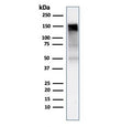 Western blot testing of human A431 cell lysate with EGFR antibody (clone rGFR/1667). Expected molecular weight: ~134/170 kDa (unmodified/glycosylated).