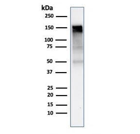 Western blot testing of human A431 cell lysate with EGFR antibody (clone rGFR/1667). Expected molecular weight: ~134/170 kDa (unmodified/glycosylated).