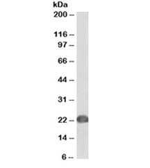 Western blot testing of human Jurkat lysate with biotinylated DJ-1 antibody at 0.2ug/ml. Predicted molecular weight ~20 kDa. An NAP blocker was used in place of non-fat milk as blocking solution and diluent. (1)