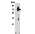 Western blot testing of 1) non-transfected and 2) transfected 293 cell lysate with BIRC3 antibody. Predicted molecular weight ~68 kDa.