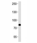 Western blot analysis of lysate from Ramos cell line using SYK antibody at 1:1000. Predicted molecular weight ~72 kDa