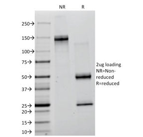 SDS-PAGE analysis of purified, BSA-free Lambda Light Chain antibody (clone ICO-106) as confirmation of integrity and purity.