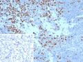 IHC staining of FFPE human tonsil tissue with Ki67 antibody (clone MKI67/8743). Inset: PBS used in place of primary Ab (secondary Ab negative control). HIER: boil tissue sections in pH 9 10mM Tris with 1mM EDTA for 20 min and allow to cool before testing.
