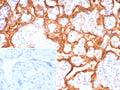 IHC staining of FFPE human placental tissue with Growth Hormone antibody (clone GH/8215R). Inset: PBS used in place of primary Ab (secondary Ab negative control). HIER: boil tissue sections in pH 9 10mM Tris with 1mM EDTA for 20 min and allow to cool before testing.