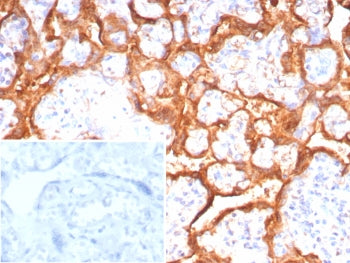 IHC staining of FFPE human placental tissue with Growth Hormone antibody (clone GH/8215R). Inset: PBS used in place of primary Ab (secondary Ab negative control). HIER: boil tissue sections in pH 9 10mM Tris with 1mM EDTA for 20 min and allow to cool before testing.