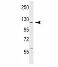 ABL1 antibody western blot analysis in MCF-7 lysate. Predicted molecular weight ~120-150 kDa.