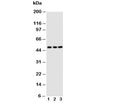 Western blot testing of CXCR4 antibody; Lane 1: M231; 2: MCF-7; 3: Jurkat cell lysate. Predicted molecular weight ~40 kDa but may be observed at higher molecular weights due to glycosylation.