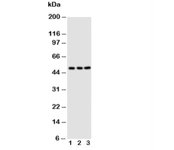 Western blot testing of CXCR4 antibody; Lane 1: M231; 2: MCF-7; 3: Jurkat cell lysate. Predicted molecular weight ~40 kDa but may be observed at higher molecular weights due to glycosylation.