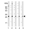 Western blot testing of 1) human brain, 2) mouse brain, 3) human MDA-MB-231, 4) mouse cerebellum and 5) human cerebellum lysate with Rab-23 antibody. Predicted molecular weight: ~27 kDa.