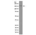 Western blot testing of human HeLa cell lysate with Brd4 antibody. Predicted molecular weight ~156 kDa (long form, can be observed at 200+ kDa) and ~81 kDa (short form).
