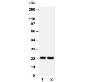 Western blot testing of FGF9 antibody and Lane 1: rat brain; 2: human HeLa lysate; Predicted molecular weight ~23 kDa with a possible 45-55 kDa dimer.