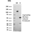 SDS-PAGE analysis of purified, BSA-free CEA antibody (clone C66/1292) as confirmation of integrity and purity.