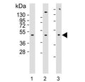 Western blot testing of human 1) MCF7, 2) MDA-MB-231 and 3) SK-BR-3 cell lysate with Alpha-2B Adrenergic Receptor antibody. Predicted molecular weight ~50 kDa.