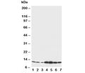 Western blot testing of S100 beta antibody and Lane 1: rat brain; 2: rat brain; 3: MCF-7; 4: HeLa; 5: SMMC-7721; 6: Jurkat; 7: COLO320 cell lysate. Predicted/observed molecular weight: ~11kDa.