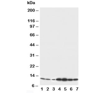 Western blot testing of S100 beta antibody and Lane 1: rat brain; 2: rat brain; 3: MCF-7; 4: HeLa; 5: SMMC-7721; 6: Jurkat; 7: COLO320 cell lysate. Predicted/observed molecular weight: ~11kDa.