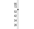 Western blot analysis of ACSL3 antibody and human 293 lysate. Predicted molecular weight ~80 kDa.