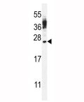 CT45A antibody western blot analysis in WiDr lysate