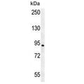 AXIN2 antibody western blot analysis in human Jurkat lysate. Expected molecular weight: 93-100 kDa.
