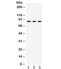 Western blot testing of human 1) A549, 2) 293 and 3) HeLa cell lysate with Complement Factor B antibody. Expected/observed molecular weight ~86 kDa.