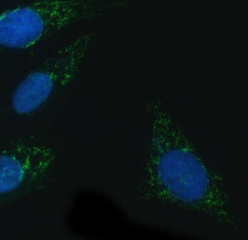Immunofluorescent staining of FFPE human U-2 OS cells with NADPH oxidase 4 antibody (green) and DAPI nuclear stain (blue). HIER: steam section in pH6 citrate buffer for 20 min.