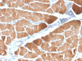 IHC testing of FFPE human skeletal muscle with recombinant Desmin antibody (clone DES/2960R). Required HIER: boil tissue sections in 10mM Tris with 1mM EDTA, pH 9 for 10-20 min and allow to cool before testing.