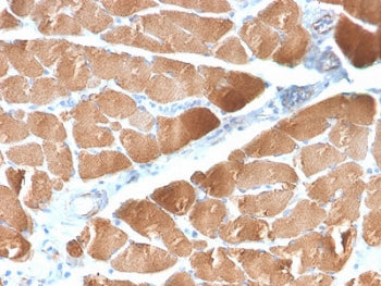 IHC testing of FFPE human skeletal muscle with recombinant Desmin antibody (clone DES/2960R). Required HIER: boil tissue sections in 10mM Tris with 1mM EDTA, pH 9 for 10-20 min and allow to cool before testing.