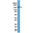 Western blot testing of human brain tissue lysate with recombinant PDGFRB antibody at 1:100. Expected molecular weight: 123-190 kDa depending on level of glycosylation.