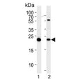 Western blot testing of human 1) HEK293 and 2) HeLa cell lysate with Interleukin-1 Receptor Antagonist antibody. Predicted molecular weight ~20 kDa.
