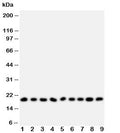 Western blot testing of Ribonuclease A antibody and Lane 1: MCF-7; 2: U87; 3: HeLa; 4: MM231; 5: Jurkat; 6: SMMC-7721; 7: COLO320; 8: SW620; 9: CEM; Predicted size: 18KD; Observed size: 18KD