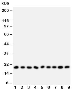 Western blot testing of Ribonuclease A antibody and Lane 1: MCF-7; 2: U87; 3: HeLa; 4: MM231; 5: Jurkat; 6: SMMC-7721; 7: COLO320; 8: SW620; 9: CEM; Predicted size: 18KD; Observed size: 18KD