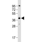 Western blot testing of human HeLa cell lysate with DNAJB4 antibody at 1:2000. Predicted molecular weight: 38 kDa.