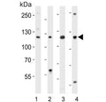 Western blot testing of mouse 1) NIH 3T3, 2) spleen, 3) testis and 4) thymus lysate with Trim 24 antibody. Expected molecular weight: 117-140 kDa.
