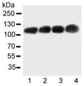 Western blot testing of CEA antibody and Lane 1: Recombinant human CEA protein 10ng; Lane 2: 5ng; 3: 2.5ng; 4: 1.25ng