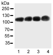 Western blot testing of CEA antibody and Lane 1: Recombinant human CEA protein 10ng; Lane 2: 5ng; 3: 2.5ng; 4: 1.25ng