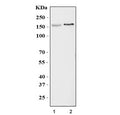 Western blot testing of 1) rat brain and 2) mouse brain tissue lysate with KCNH2 antibody. Expected molecular weight: 127-155 kDa.