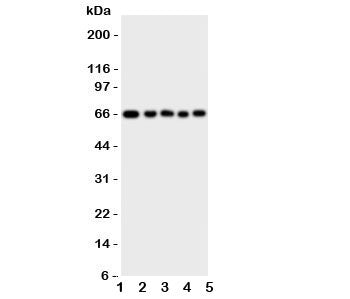 Western blot testing of MBD4 antbody; Lane 1: rat brain; 2: (r) kidney; 3: human A549; 4: (h) HeLa; 5: (h) MCF-7 cell lysate. Predicted molecular weight ~66 kDa.