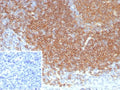 IHC staining of FFPE human tonsil tissue with CD22 antibody (clone BLCAM/8113R). Inset: PBS instead of primary antibody, secondary control.